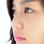 Dermal Filler Juvederm